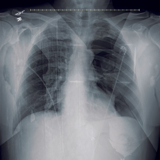 Slow Draw - Roadblock (video premiere)